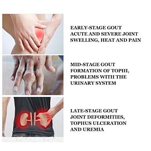 Canyite Parche para aliviar el dolor, Parche para aliviar el dolor, Parche chino Parche para aliviar el dolor para la rodilla Hombro Hueso Hiperplasia Hernia de disco lumbar Lesión por caída