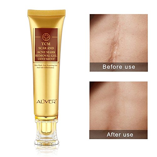 Crema para Eliminar Cicatrices de Acné 2 piezas, Gel para Cicatrices TCM para Rostro y Cuerpo, Repara Eficazmente Viejas Cicatrices / Quemaduras / Cortes / Manchas de Acné / Enrojecimiento de Piel