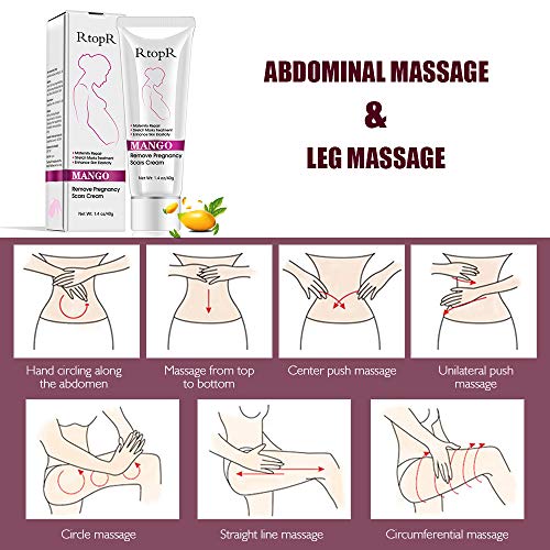 Crema para estrías, Eliminar cicatrices del embarazo, Tratamiento de las estrías, Reparación de maternidad, Eliminar estrías del embarazo,40g