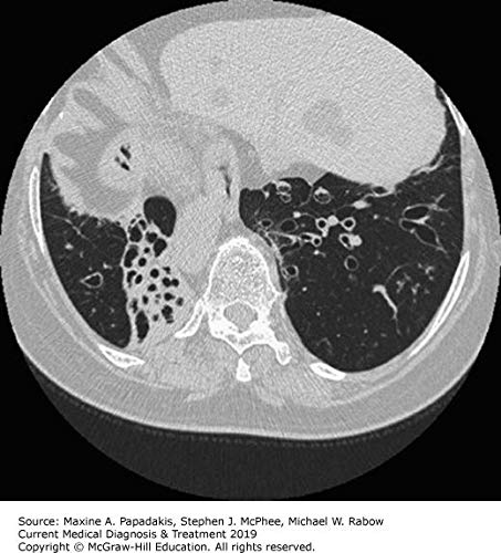 Current medical diagnosis and treatment. Con espansione online (Scienze)