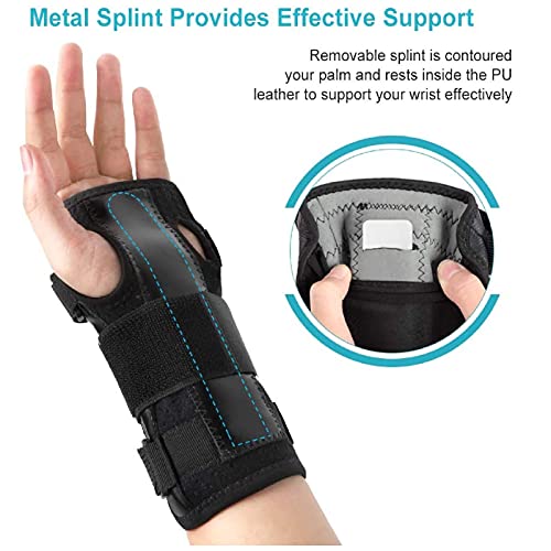 Muñequera y ortesis de mano con férula extraíble, alivio del dolor del túnel carpiano, esguinces y tendinitis, para aliviar el dolor