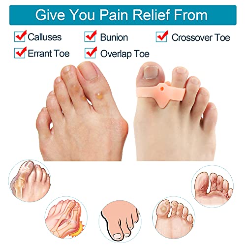 Sumiwish 10 correctores de juanetes de gel, separadores de dedos con 2 bucles, compañero de dedo gordo de gel suave, enderezador de dedos, adecuado para aliviar el dolor de juanetes