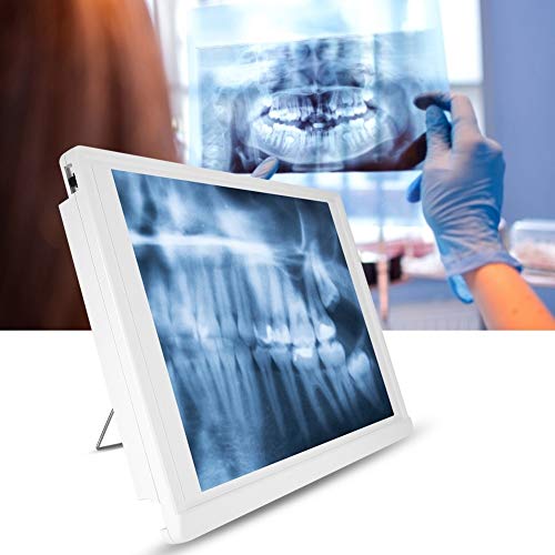 Tarente Negatoscopio, Plug AC110-220V UE película Dental Visor Ver Viewbox Box LED con el Soporte del Chip de la Abrazadera