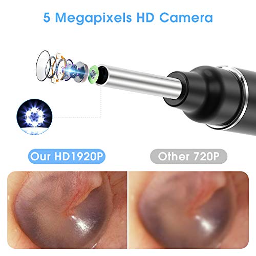 VITCOCO Otoscopio Wifi Camara 5MP HD Limpiador de Oidos 3mm WIFI con 6 Luces LED para iPhone/iPad/iOS/Android