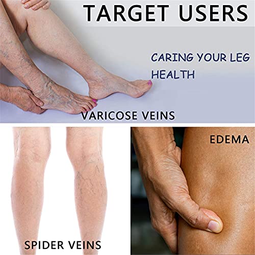ADMLZQQ Medias De Compresión Sin Pies hasta El Muslo para Mujeres Y Hombres, Medias De Soporte Firme para Venas Varicosas Graduadas, 23-32 mmHg, 1 Par,Skin Tone,S