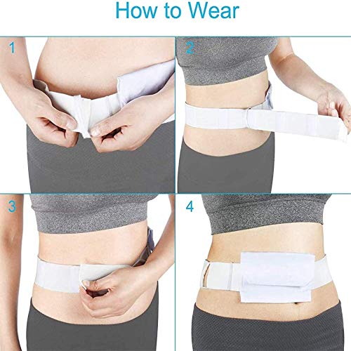 MILECN Cinturón De Diálisis Abdominal para Hombres Y Mujeres - Protector De Catéter Peritoneal, Dispositivo De Fijación De Cinturón De Almacenamiento De Tubo Abdominal para Tubo Peg Fijo,5pcs