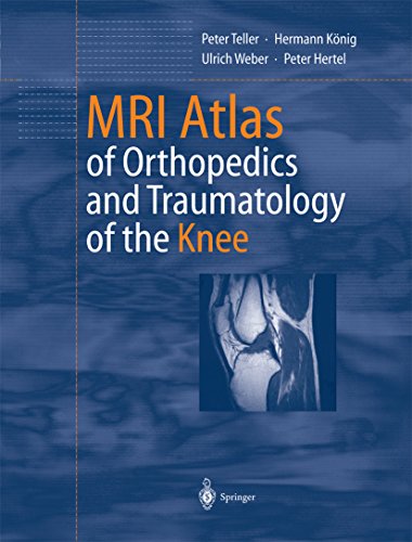 MRI Atlas of Orthopedics and Traumatology of the Knee (English Edition)
