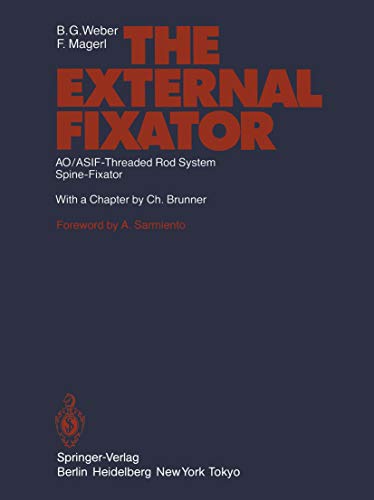 The External Fixator: AO/ASIF-Threaded Rod System Spine-Fixator (English Edition)