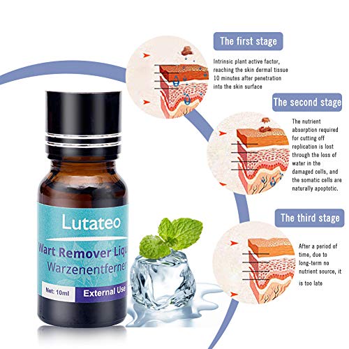 Verrugas, Wart Remover, Wart Remover Liquid, Removedor de verrugas liquido