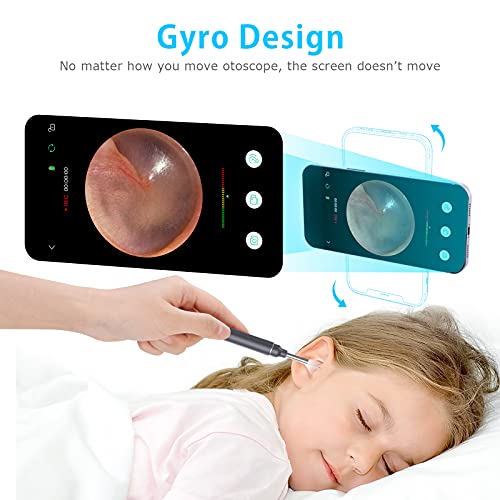 VITCOCO Otoscopio Wifi Camara 5MP HD Limpiador de Oidos 3mm WIFI con 6 Luces LED para iPhone / iPad / iOS / Android