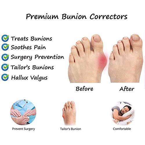 ZHXMYD Sandalias Férulas Mujer Dedo Grande Plano Hallux Valgus Ortopédico para Tratamiento Sandalias De Corrección De Dedo Gordo De Cuero PU Sandalias De Verano con Punta Abierta