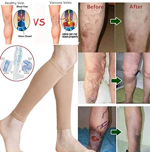 20-30 mmHg medias antiembolia medias de compresión de pantorrilla para espinillera, venas varicosas (medianas)