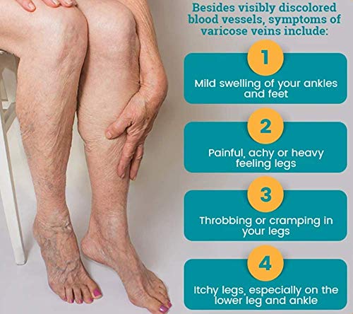 20-30 mmHg medias antiembolia medias de compresión de pantorrilla para espinillera, venas varicosas (medianas)
