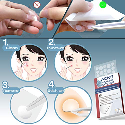 216 PCS Parches Para Acné, Uso Diurno y Nocturno Parches Acne 2 en 1, Parches Para Espinillas Hidrocoloides Eficaces e Invisibles, Impermeable y Transpirable Parches Absorbentes Parches de Acné