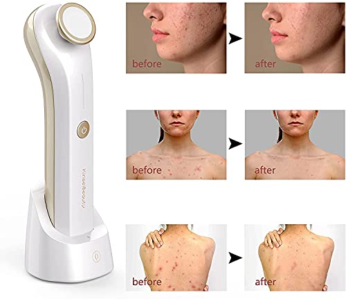 Aparato de belleza de plasma, cuidado facial, antiinflamatorio facial anti-acné, esterilización. (ORO) …