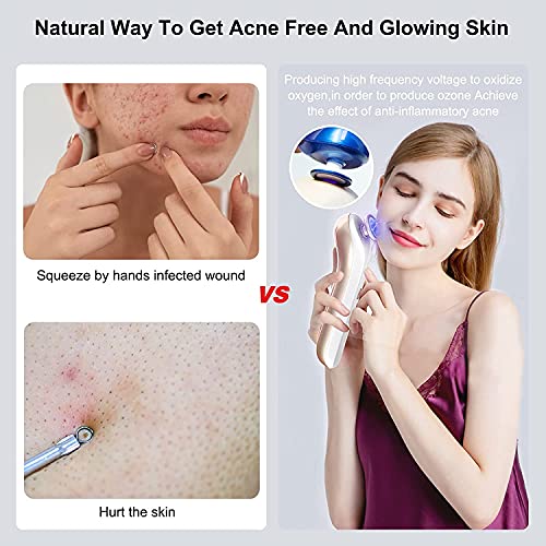 Aparato de belleza de plasma, cuidado facial, antiinflamatorio facial anti-acné, esterilización. (ORO) …