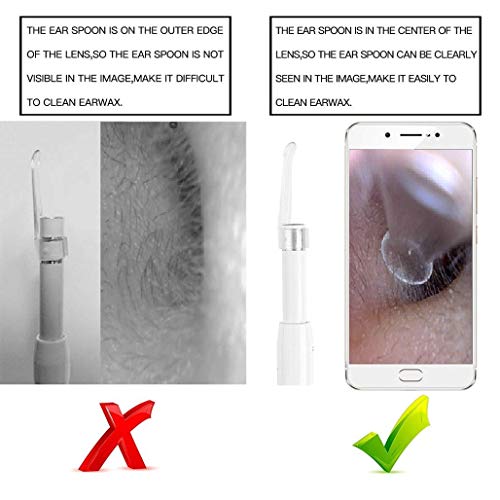 GXXDM Otoscopio inalámbrico 720P HD, Herramienta de eliminación de Cera WiFi, endoscopio de Limpieza de Orejas de 5,5 mm de diámetro con 6 LED, cámara de inspección de otoscopio de Oreja