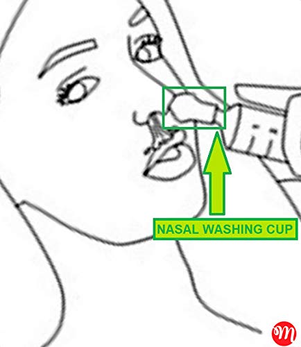 Lavaje nasal by Marco Maltoni (1 jeringa de 60 ml + 3 aceitunas nasales anchas) para lavado del cable nasal con solución fisiológica RINOWASH