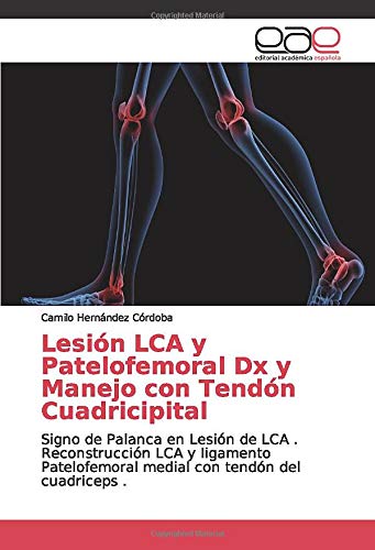 Lesión LCA y Patelofemoral Dx y Manejo con Tendón Cuadricipital: Signo de Palanca en Lesión de LCA . Reconstrucción LCA y ligamento Patelofemoral medial con tendón del cuadriceps .