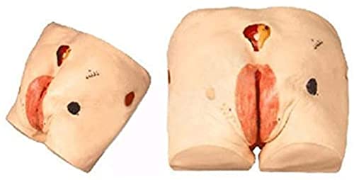Modelo de enfermería de úlceras por presión (úlceras por presión) para personas mayores, sinusitis, fístula, podredumbre, infección por escaras, exposición ósea, quemaduras, heridas suturadas par