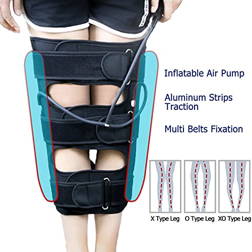 O / X Cinturón De Corrección De Tipo De Pierna, Rodilleras Knock, Banda De Piernas Con Arco De Deformidad Valgus, Cinturón Corrector De Postura De Piernas, Cinturón Enderezado Para Niños Y Adultos