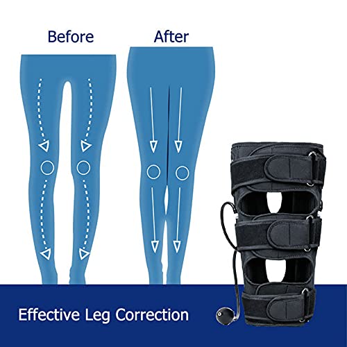 O / X Cinturón De Corrección De Tipo De Pierna, Rodilleras Knock, Banda De Piernas Con Arco De Deformidad Valgus, Cinturón Corrector De Postura De Piernas, Cinturón Enderezado Para Niños Y Adultos