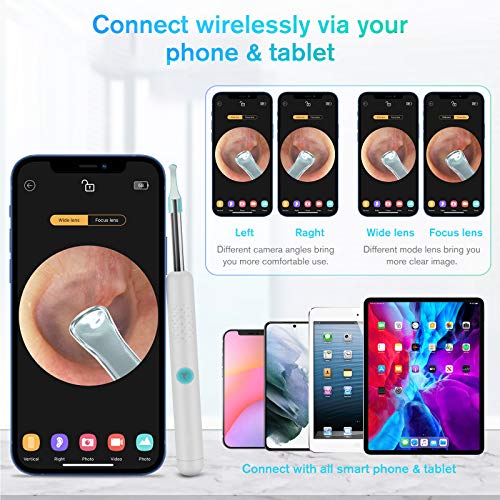 Otoscopio BEBIRD Endoscopio Camara Endoscopica 1080P FHD Otoscopio WIFI con 6 LED limpiador de cera de oído para niños, adultos y mascotas Ajustables para iOS Android Tabletas (Blanca)
