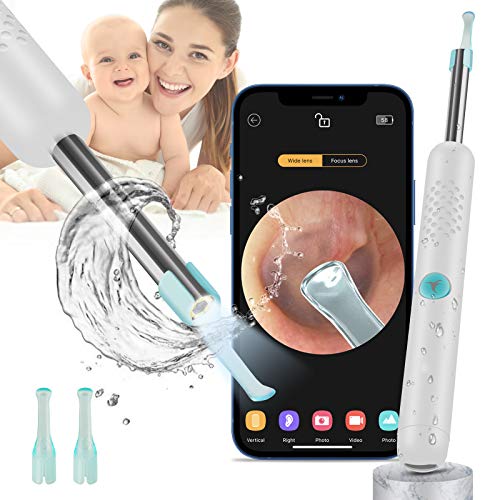Otoscopio BEBIRD Endoscopio Camara Endoscopica 1080P FHD Otoscopio WIFI con 6 LED limpiador de cera de oído para niños, adultos y mascotas Ajustables para iOS Android Tabletas (Blanca)