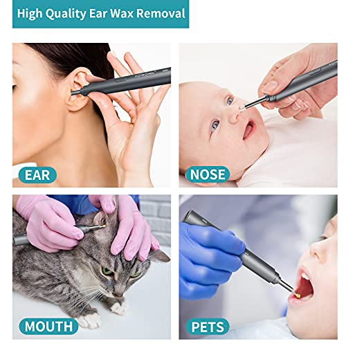 Otoscopio Digital WiFi, BOMBOMDA 3.5mm 1080P HD Endoscopio Oido, Limpieza Cerumen Oído con Soporte para Móvil, Herramienta de Limpieza de Oidos y 6 LED para iPhone/Movil Android/PC