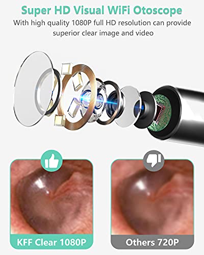 Otoscopio Digital Wifi, OVIFM HD 1080P Mini Endoscopio con 6 Luces LED, Camara Endoscopica, Endoscopio Oido para Android/Iphone, IP67 Cinturón Impermeable con 8 Kit de Eliminación de Cerumen-Verde