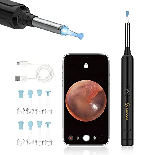 Otoscopio Digital WiFi, VITCOCO Camara Endoscopica Inalámbrico, Oídos Limpiador con 6 Luces LED, Compatible con iPhone, iPad, Android, para Niños, Adultos, negro