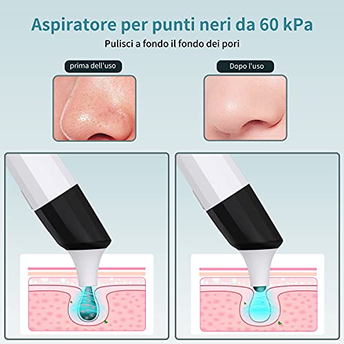 PeroBuno Limpiador de Poros con Camara y 4 Cabezales para Espinillas puntos negros y Acné Kit para la limpieza de puntos negros de la nariz quitar puntos negros