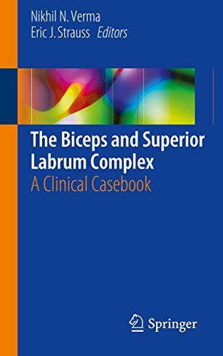 The Biceps and Superior Labrum Complex: A Clinical Casebook (English Edition)