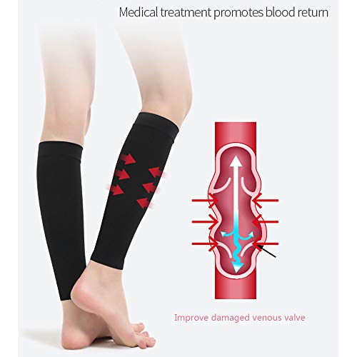 wolfjuvenile Apoyo Graduado De Varicosa para Edema - Manga De CompresióN para La Pantorrilla, Venas Varicosas En Las Piernas Medias EláSticas (15-21Mm HG),Black-XXL