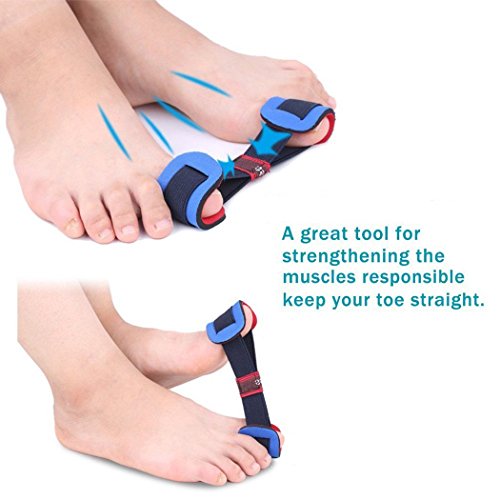 Juego de 5 piezas para corrector de juanetes y alivio del dolor nocturno Hallux Valgus