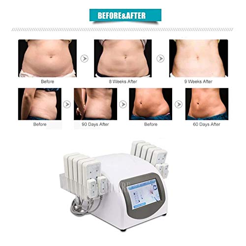 QINYUP Portátil de Uso en el hogar Lipolaser Profesional Que Adelgaza la máquina 10 largepads 4 smallpad Lipo láser Equipo de la Belleza para la pérdida de Peso