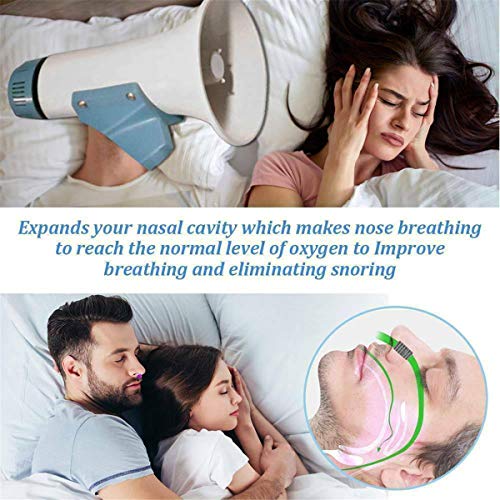 Soudream Dispositivo Electrónico Antirronquidos Micro Cpap USB, Dispositivo Eléctrico Antirronquidos - Dispositivos para La Apnea del Sueño, Dispositivo Electrónico Antirronquidos (Blue)
