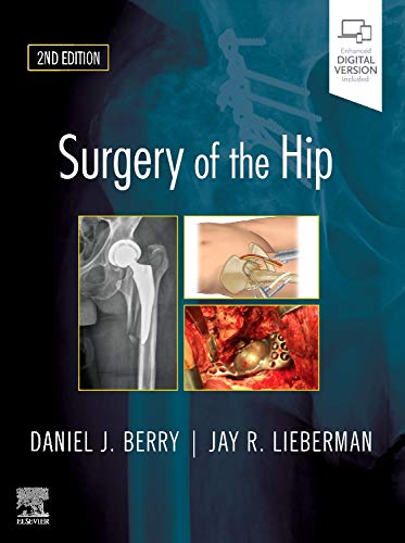 Surgery of the Hip, 2e: Expert Consult - Online and Print