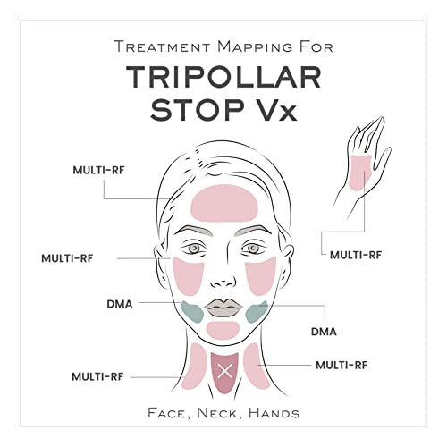 TRIPOLLAR Máquina facial de alta frecuencia Stop Vx – Tecnología de patente (Multi RF y activación muscular directa), dispositivo de tonificación, reducción de arrugas