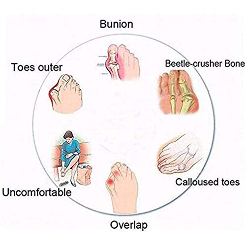 ZHXMYD Verano Mujer Sandalias Planas Dedo Grande Hallux Valgus Ortopédicas Cómodas Chanclas para Tratamiento Moda Sexy Diapositivas Ocio Al Aire Libre Playa Sandalias De Viaje