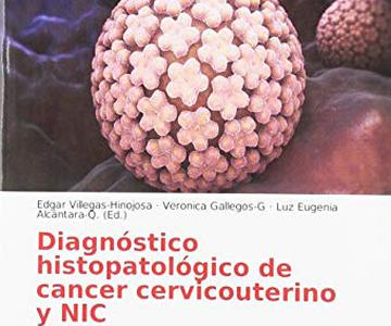 tipos de cervicales