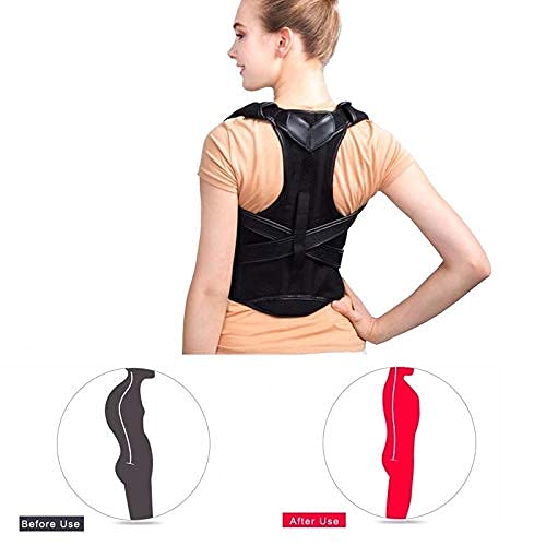 Corrector de postura, 1 pieza, corrector de postura, soporte de cifosis, alivio del dolor muscular, alivio del dolor de espalda, soporte de postura para mujeres, hombres, soporte de apoyo (tamaño: