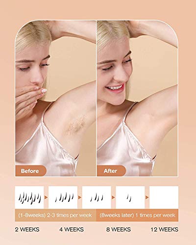 IPL Depiladora de Luz Pulsada 999,000 Flashes, Permanente Sin Dolor, Sistemas de Depilación Dispositivo Profesional ,para Piernas Cara Cuerpo,para Mujer y Hombre