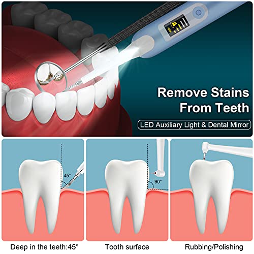 Kit de limpieza dental eléctrico,Limpieza Dental 4in1,Limpieza de los Dientes Bucal Limpiador con 5 Modos de Cepillado, 4 Recambio Cabezales kit