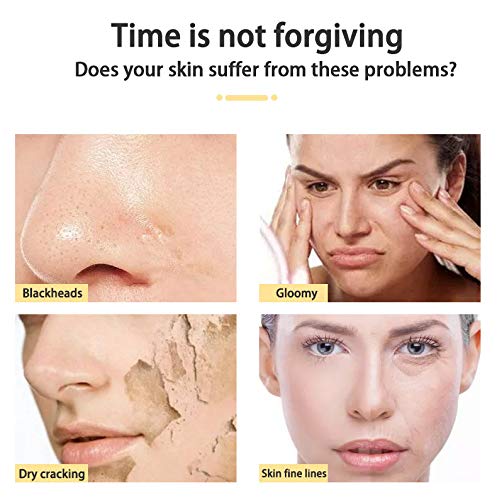 Masajeador Facial,Dispositivo de Masaje,Facial Aparato Radiofrecuencia, LED, Antiarrugas, Anti-envejecimiento, Rejuvenecimiento, Limpieza Profunda