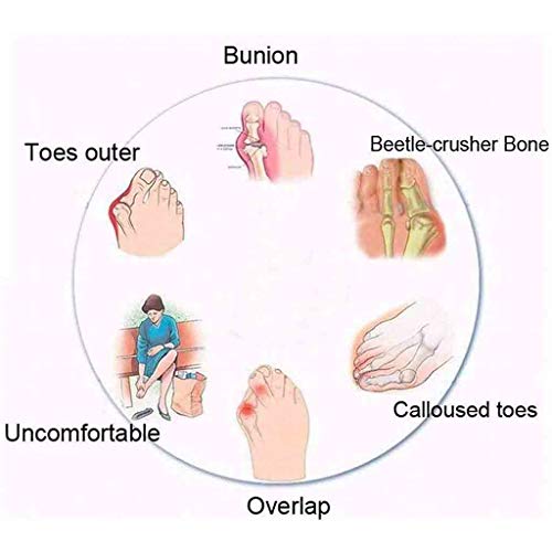 Mujeres Bunion Corrector Platform Sandal Comfy Casual Toe Correction Sandalias De Plataforma Juanete Corrector Ortesis Sandalias del Dedo del,Oro,36