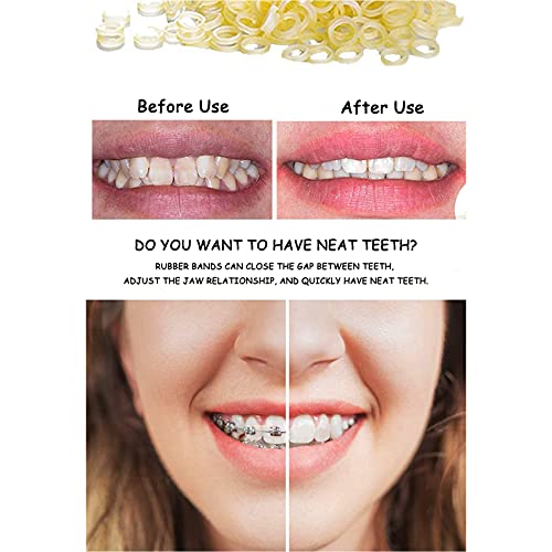 Ortodoncia Tirantes elásticos Bandas de goma dental para aparatos ortopédicos bandas de goma dental (500 piezas) (Ardilla de 1/8")