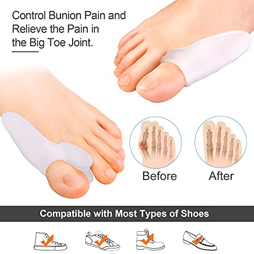 Sumiwish 2 férulas para juanetes y 4 protectores de juanetes de gel, corrector de juanetes y kit de alivio para aliviar el dolor en los dedos gordos del pie