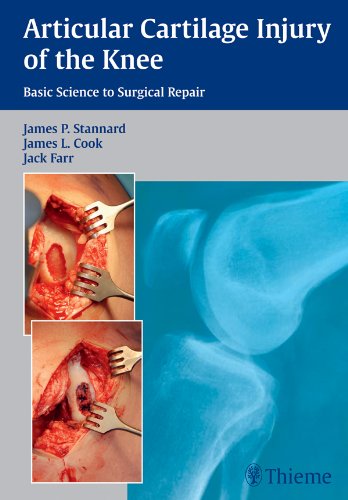 Articular Cartilage Injury of the Knee: Basic Science to Surgical Repair (English Edition)