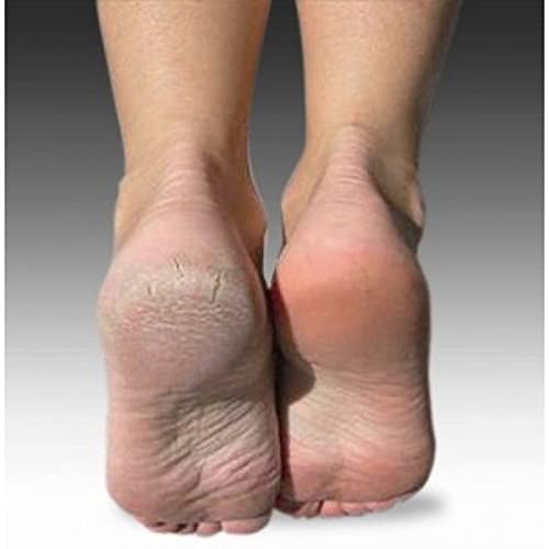 Lima eléctrica de alta precisión para los callos y las durezas de los pies que pule y aspira la piel muerta de cualquier zona del pie